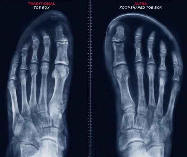 chaussure trail ALTRA Lone Peak 4